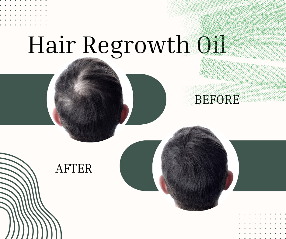 Hair Regrowth Oil